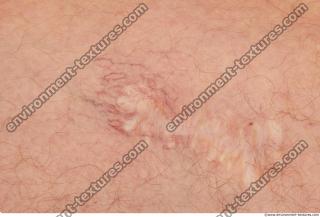 Photo Textures of Human Skin